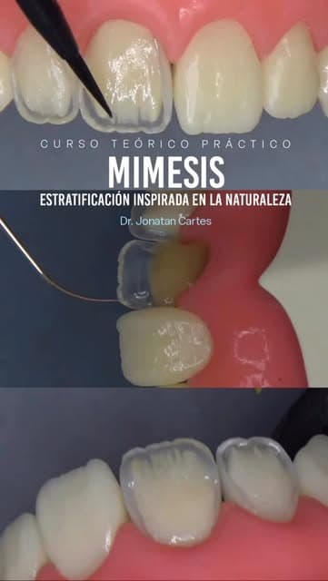 Contenido en video de Costa Rica Dental Training Center